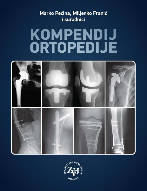 Kompendij ortopedije
