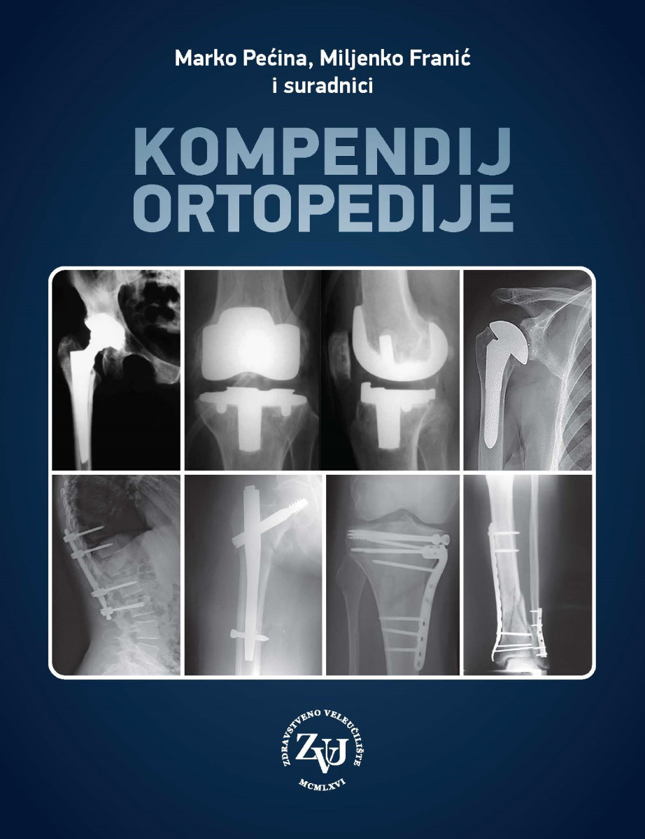 Kompendij ortopedije e-izdanje